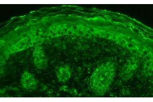 Immunohistochemistry analysis using Rabbit Anti-Calnexin Polyclonal Antibody (ABIN361826 and ABIN361827). (Calnexin 抗体  (C-Term))