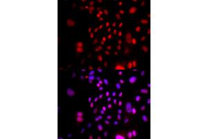 Immunofluorescence analysis of U2OS cells using RFC4 antibody (ABIN5973195). (RFC4 抗体)