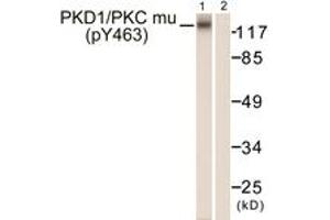 Western blot analysis of extracts from HepG2 cells, using PKD1/PKC mu (Phospho-Tyr463) Antibody. (PKC mu 抗体  (pTyr463))