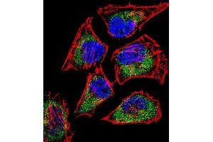 Fluorescent confocal image of Hela cell stained with SIX5 Antibody (Center) (ABIN656668 and ABIN2845908). (Six5 抗体  (AA 257-286))