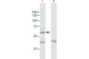 Western Blot analysis of ZNF92 expression in transfected 293T cell line by ZNF92 MaxPab polyclonal antibody. (ZNF92 抗体  (AA 1-517))
