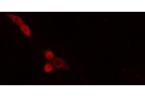 ABIN6274665 staining HepG2 cells by IF/ICC. (DNAJB4 抗体  (Internal Region))