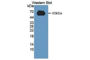 Western Blotting (WB) image for anti-Low Density Lipoprotein Receptor (LDLR) (AA 263-509) antibody (ABIN1868940) (LDLR 抗体  (AA 263-509))