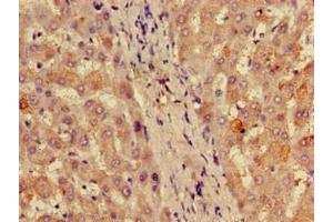 Immunohistochemistry of paraffin-embedded human liver tissue using ABIN7142793 at dilution of 1:100 (RPL28 抗体  (AA 2-137) (Biotin))