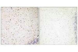 Immunohistochemistry analysis of paraffin-embedded human brain tissue, using PAK7 antibody. (PAK7 抗体  (C-Term))