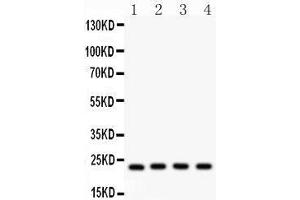 Anti- BAK Picoband antibody, Western blotting All lanes: Anti BAK  at 0. (BAK1 抗体  (AA 22-211))