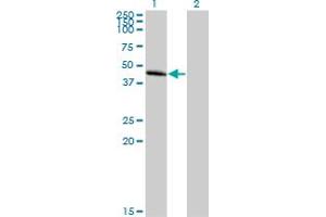 Western Blot analysis of CCBP2 expression in transfected 293T cell line by CCBP2 MaxPab polyclonal antibody. (CCBP2 抗体  (AA 1-384))