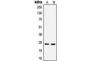 Western blot analysis of HSP27 (pS15) expression in HeLa Anisomycin-treated (A), MCF7 (B) whole cell lysates. (HSP27 抗体  (N-Term, pSer15))