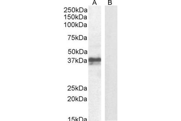 FOXI3 抗体  (Internal Region)