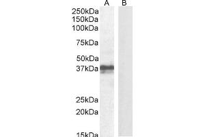 ABIN625827 (1 μg/mL) staining of Mouse Skin lysate (A) + peptide (B) (35 μg protein in RIPA buffer). (FOXI3 抗体  (Internal Region))