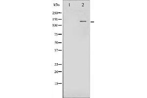 Western blot analysis of FGFR1 phosphorylation expression in Insulin treated 293 whole cell lysates,The lane on the left is treated with the antigen-specific peptide. (FGFR1 抗体  (pTyr654))