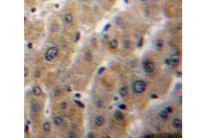 IHC-P analysis of Liver tissue, with DAB staining. (PLA1A 抗体  (AA 148-295))