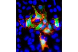 Immunofluorescent analysis of GFP using either natural fluorescence (green) or an GFP antibody (red) in Hela(human cervical epithelial adenocarcinoma cell line) cells transfected with GFP recombinant protein. (GFP Tag 抗体)