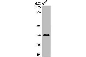 Western Blot analysis of HeLa cells using MC2-R Polyclonal Antibody (MC2R 抗体  (C-Term))