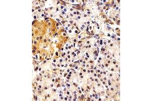 Immunohistochemical analysis of paraffin-embedded H. (ING4 抗体  (C-Term))