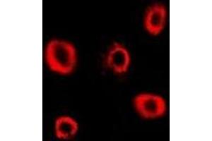 Immunofluorescent analysis of RRM2 staining in Hela cells. (RRM2 抗体)