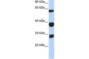 Western Blotting (WB) image for anti-Small Nuclear Ribonucleoprotein Polypeptides B and B1 (SNRPB) antibody (ABIN2458499)