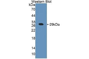 Detection of Recombinant CHN2, Mouse using Polyclonal Antibody to Chimerin 2 (CHN2) (CHN2 抗体  (AA 101-323))