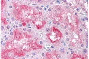 Human Kidney (formalin-fixed, paraffin-embedded) stained with USP33 antibody ABIN213600 at 5 ug/ml followed by biotinylated goat anti-rabbit IgG secondary antibody ABIN481713, alkaline phosphatase-streptavidin and chromogen. (USP33 抗体  (Internal Region))