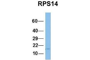 Host:  Rabbit  Target Name:  RPS14  Sample Type:  Human Fetal Brain  Antibody Dilution:  1. (RPS14 抗体  (Middle Region))