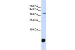 Image no. 1 for anti-F-Box Protein 10 (FBXO10) (AA 324-373) antibody (ABIN6743262) (FBXO10 抗体  (AA 324-373))
