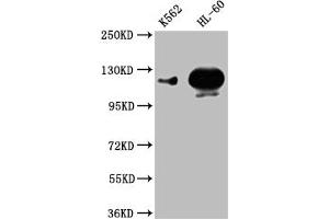 Western Blot Positive WB detected in: K562 whole cell lysate,HL-60 whole cell lysate All lanes: POTEE antibody at 1:1000 Secondary Goat polyclonal to rabbit IgG at 1/50000 dilution Predicted band size: 122 kDa Observed band size: 122 kDa (POTEE 抗体  (AA 435-606))