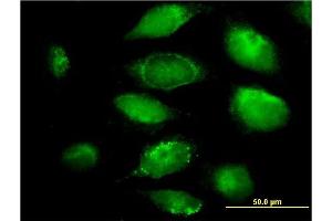 Immunofluorescence of monoclonal antibody to PLGLB2 on HeLa cell. (PLGLB2 抗体  (AA 21-96))