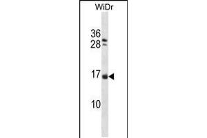 Western blot analysis in WiDr cell line lysates (35ug/lane). (NHLH1 抗体  (AA 38-67))