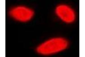Immunofluorescent analysis of ERK5 staining in K562 cells. (MAPK7 抗体)