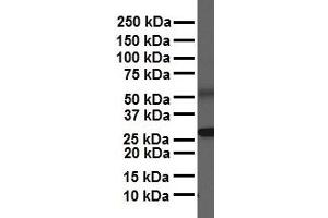 WB Suggested Anti-NR5A1 antibody Titration: 1 ug/mL Sample Type: Human heart (NR5A1 抗体  (Middle Region))