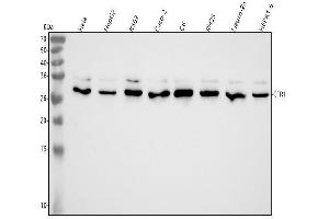 Western blot analysis of CTR1/SLC31A1 using anti-CTR1/SLC31A1 antibody (ABIN7604529).