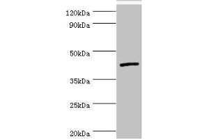 Western blot All lanes: Interleukin-13 receptor subunit alpha-2 antibody at 5 μg/mL + Hela whole cell lysate Secondary Goat polyclonal to rabbit IgG at 1/10000 dilution Predicted band size: 44 kDa Observed band size: 44 kDa (IL13RA2 抗体  (AA 27-343))