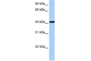 WB Suggested Anti-CC2D1B Antibody Titration: 0. (CC2D1B 抗体  (C-Term))