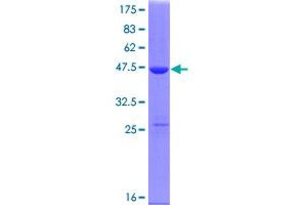 ARPC3 Protein (AA 1-178) (GST tag)