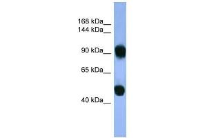 Human Muscle; WB Suggested Anti-AP1B1 Antibody Titration: 0. (AP1B1 抗体  (C-Term))