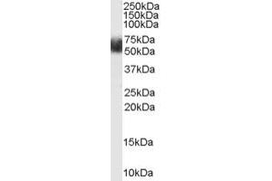 ABIN185700 (1µg/ml) staining of Human Adipose lysate (35µg protein in RIPA buffer). (FBXL3 抗体  (N-Term))
