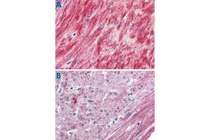 Immunohistochemistry (Formalin/PFA-fixed paraffin-embedded sections) of human prostate, smooth muscle (A) and human colon, smooth muscle (B) with ELTD1 polyclonal antibody . (ELTD1 抗体  (N-Term))