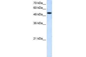 Western Blotting (WB) image for anti-Solute Carrier Family 25 (Mitochondrial Carrier, Phosphate Carrier), Member 25 (SLC25A25) antibody (ABIN2462730) (SLC25A25 抗体)