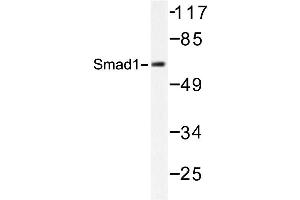Image no. 2 for anti-SMAD, Mothers Against DPP Homolog 1 (SMAD1) antibody (ABIN272123) (SMAD1 抗体)