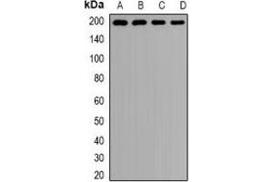 Western blot analysis of Clathrin Heavy Chain expression in Hela (A), MCF7 (B), mouse lung (C), rat brain (D) whole cell lysates. (Clathrin Heavy Chain (CLTC) 抗体)