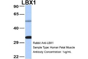 Host: Rabbit Target Name: LBX1 Sample Type: Human Fetal Muscle Antibody Dilution: 1. (Lbx1 抗体  (Middle Region))
