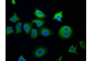 Immunofluorescence staining of A549 cells with ABIN7175340 at 1:50, counter-stained with DAPI. (SNF8 抗体  (AA 1-258))