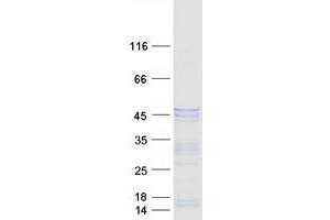 Validation with Western Blot