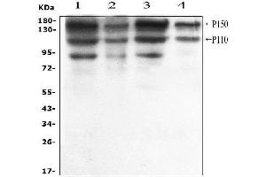 anti-Adenosine Deaminase, RNA-Specific (ADAR) (AA 128-346) antibody