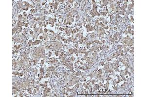 IHC analysis of ODF2L using anti-ODF2L antibody (ABIN7601202). (ODF2L 抗体  (AA 3-610))