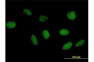 Immunofluorescence of purified MaxPab antibody to TAF6L on HeLa cell. (TAF6L 抗体  (AA 1-459))