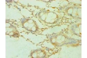Immunohistochemistry of paraffin-embedded human colon tissue using ABIN7168889 at dilution of 1:100 (SHMT1 抗体  (AA 324-483))