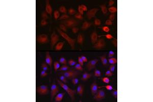 Immunofluorescence analysis of A-549 cells using NOX5 Rabbit pAb (ABIN6133125, ABIN6144754, ABIN6144755 and ABIN6222951) at dilution of 1:100 (40x lens). (NOX5 抗体  (AA 661-765))