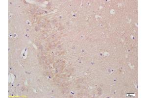 Formalin-fixed and paraffin embedded rat brain labeled with Anti--LIS1 Polyclonal Antibody, Unconjugated (ABIN676868) at 1:200, followed by conjugation to the secondary antibody and DAB staining (PAFAH1B1 抗体  (AA 311-410))