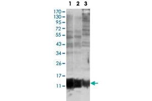 Western blot analysis of S100A10 monoclonal antobody, clone 4E7E10  against MCF-7 (1), HepG2 (2) and HeLa (3). (S100A10 抗体)